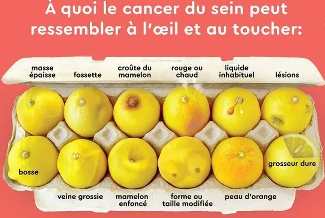 A quoi le cancer du sein peut ressembler à l'oeil et au toucher